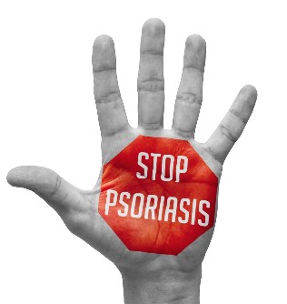Psoriasis prevention